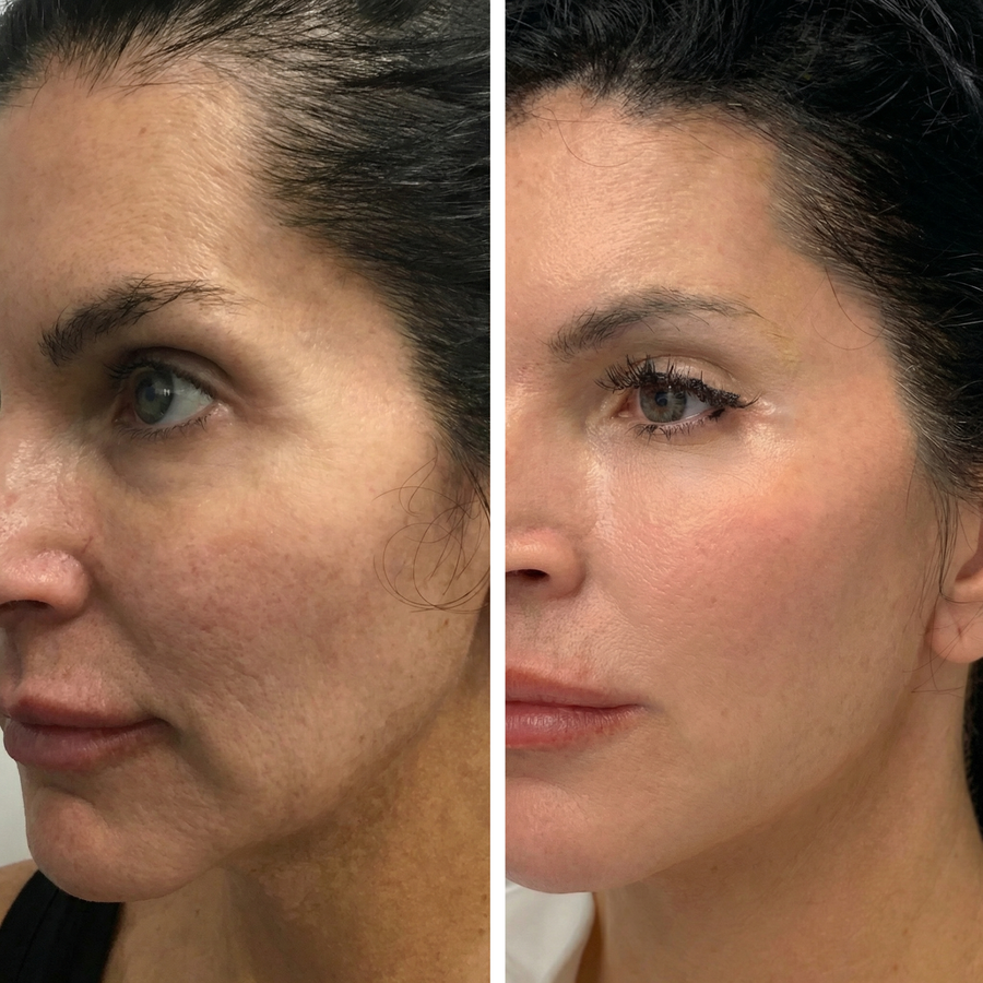 Customer result 1