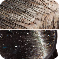 Residue buildup